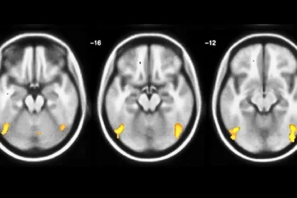 BrainScansMultitask