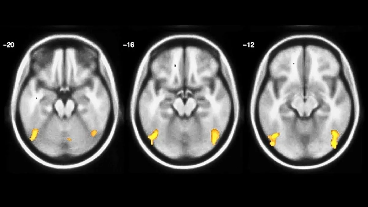 BrainScansMultitask