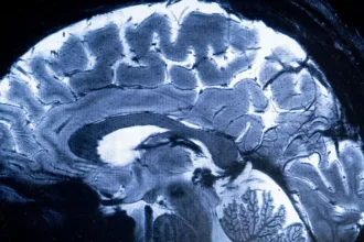 BrainStimulation