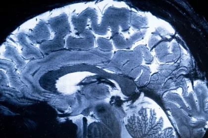 BrainStimulation