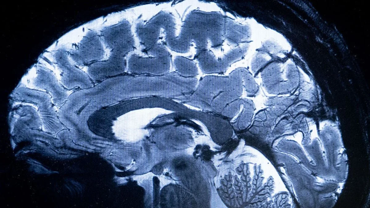 BrainStimulation