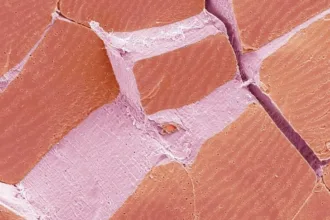 MicroMystery1