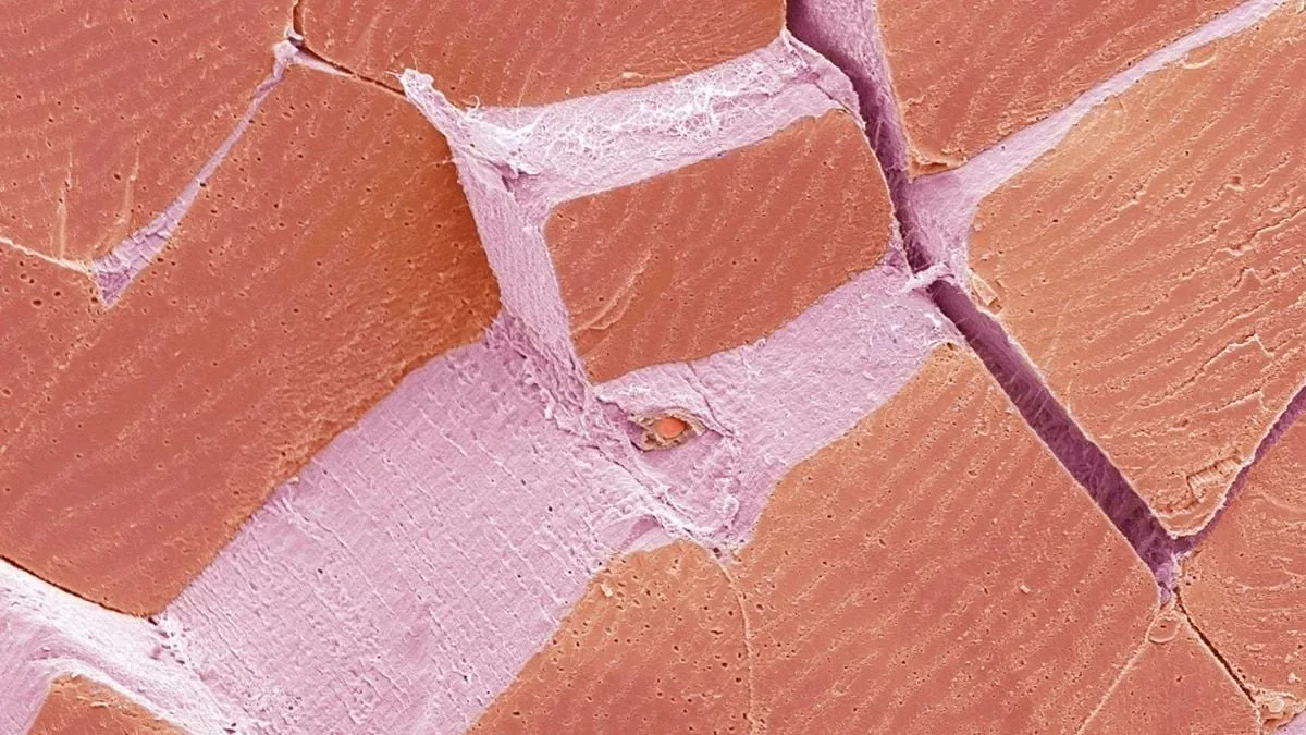 MicroMystery1