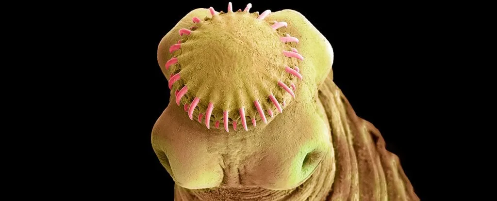 SEMofPorkTapewormInYellowWithPinkHooksAroundEndSucker 1024