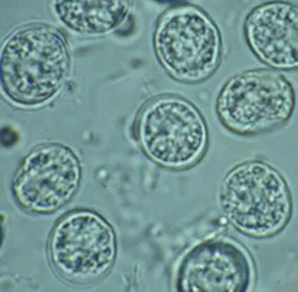 ToxoplasmaUnderMicroscope 423x415 1
