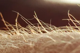 خارش ممکن است اندام حسی خاص خود را داشته باشد
