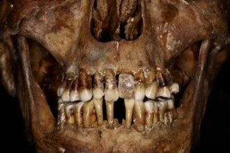 AncientTeeth