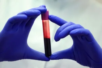 BloodSample
