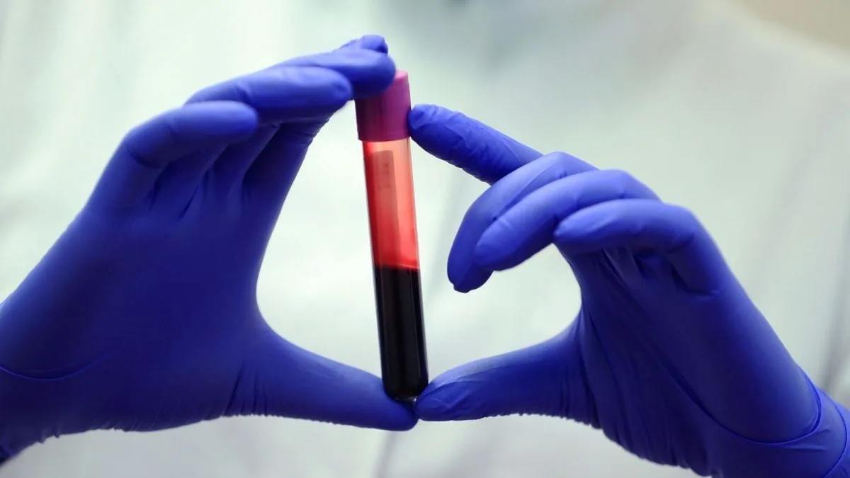 BloodSample