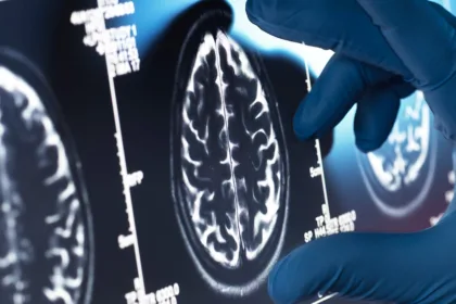 BrainScan