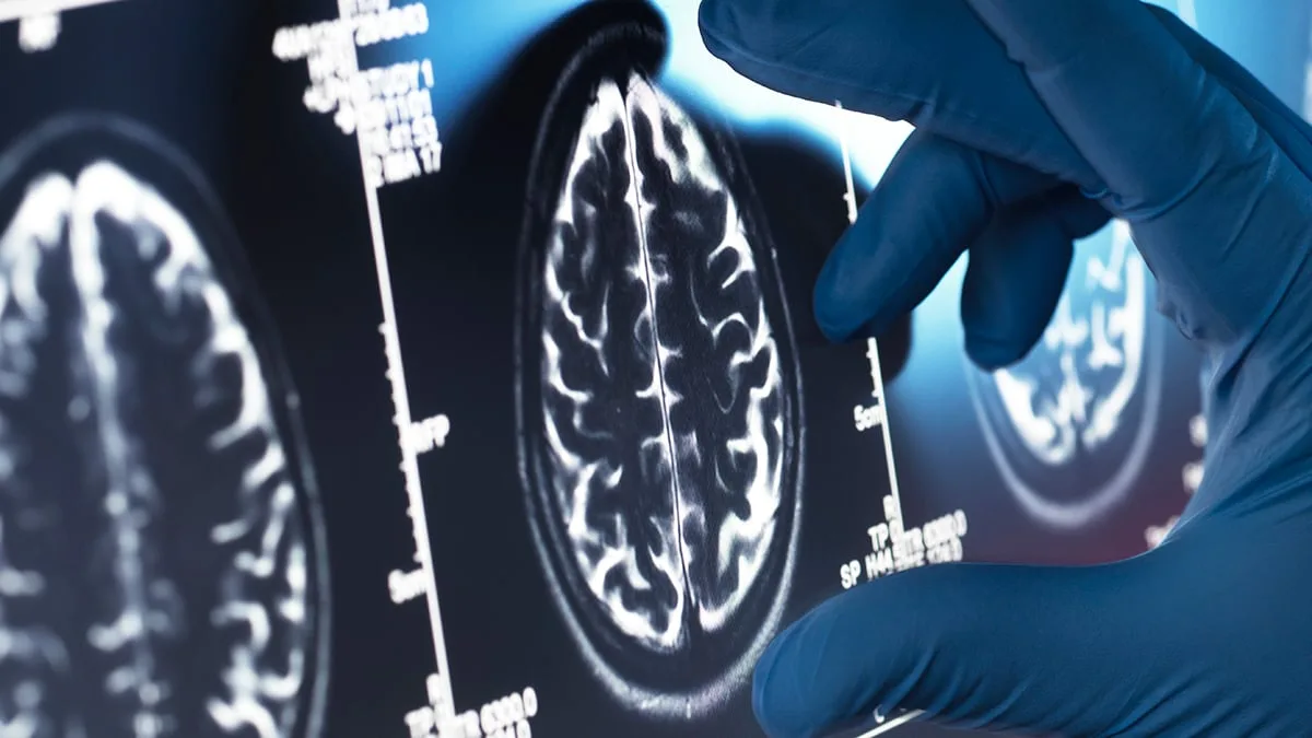 BrainScan