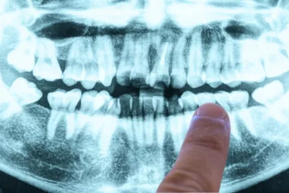 Finger pointing at mouth X ray in bright blue