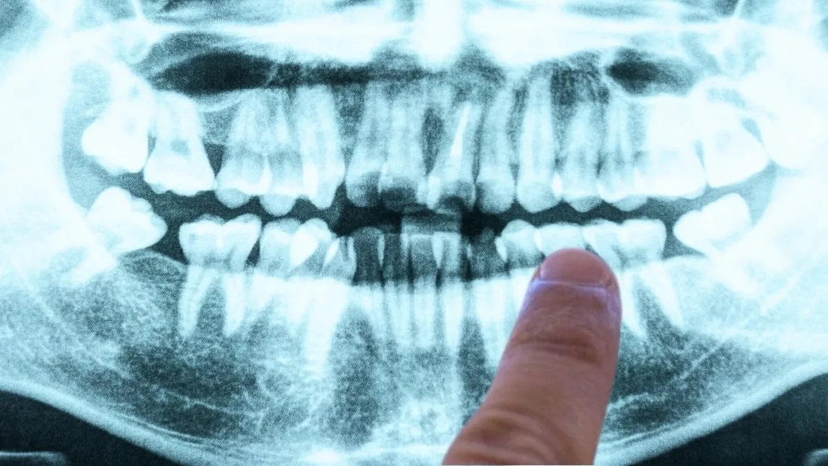 Finger pointing at mouth X ray in bright blue