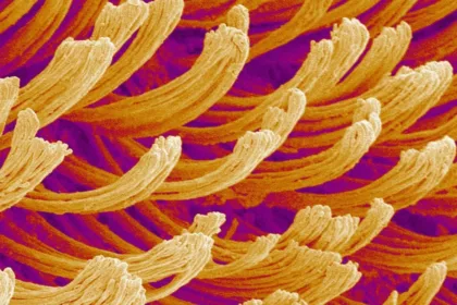 MicroMystery