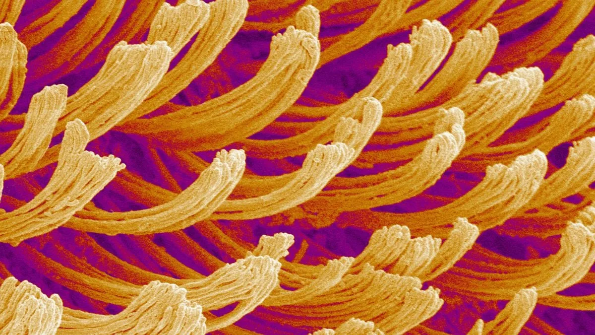 MicroMystery