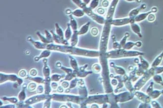 MicroMystery3 1