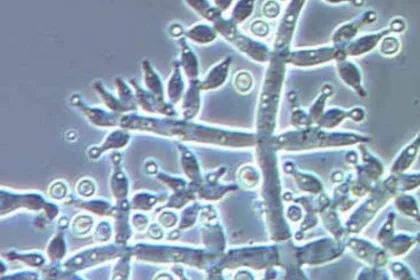 MicroMystery3 1