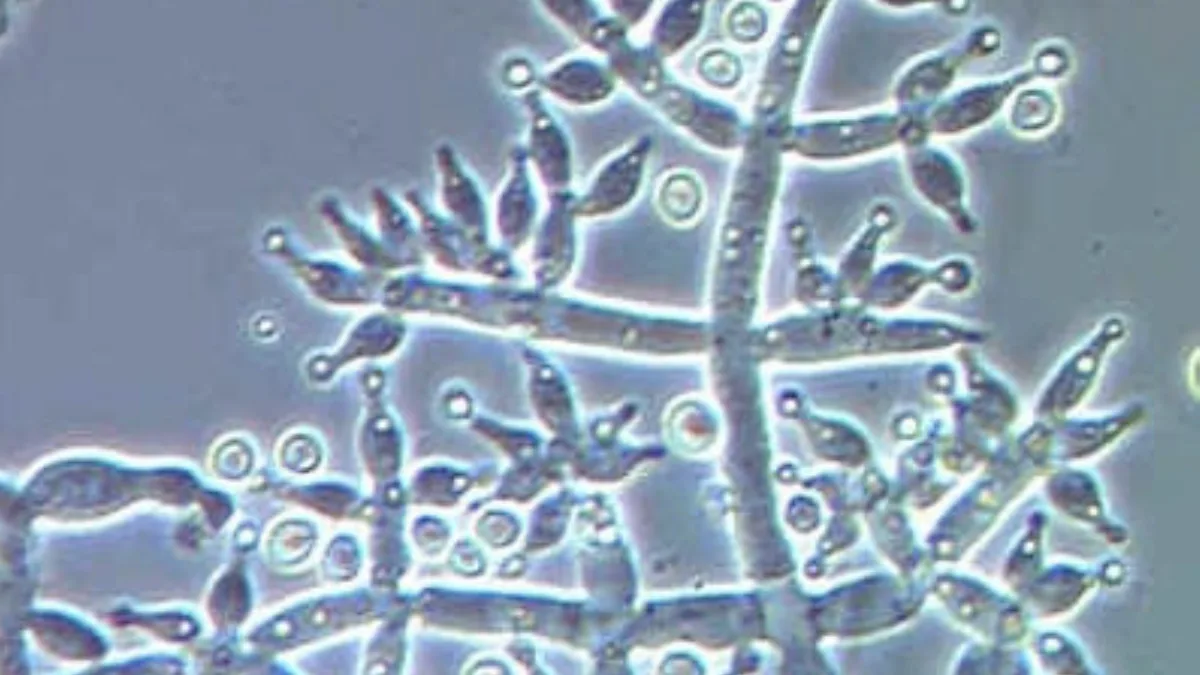 MicroMystery3 1
