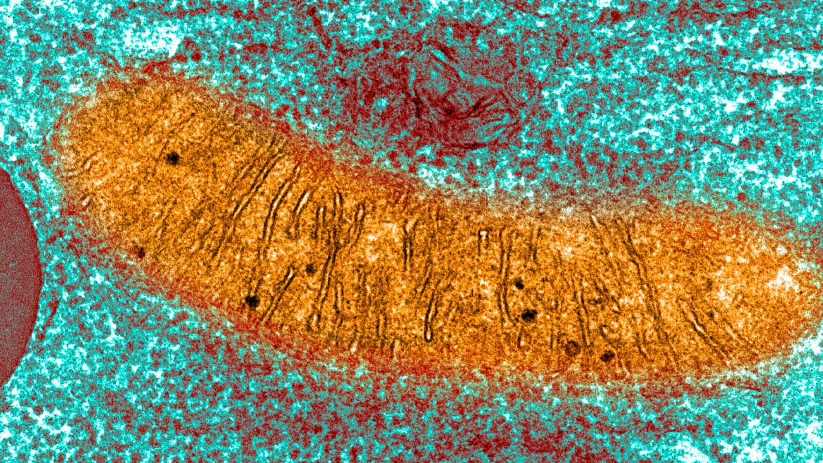 MitochondriaTEM