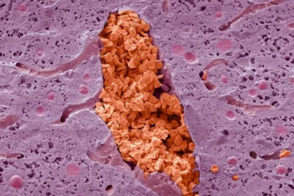 MondayMicroMysteryvein
