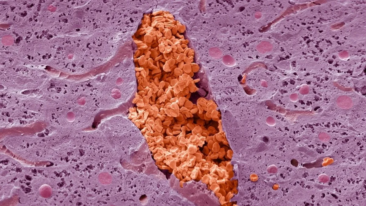 MondayMicroMysteryvein