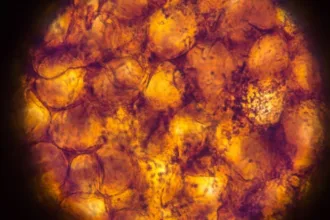 adiposeCells