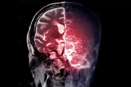 brain glow scan