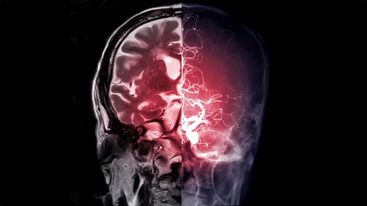 brain glow scan