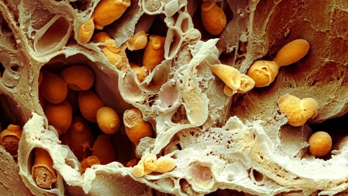 candida albicans