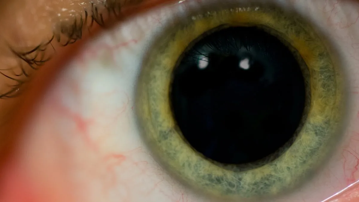 dilated pupil