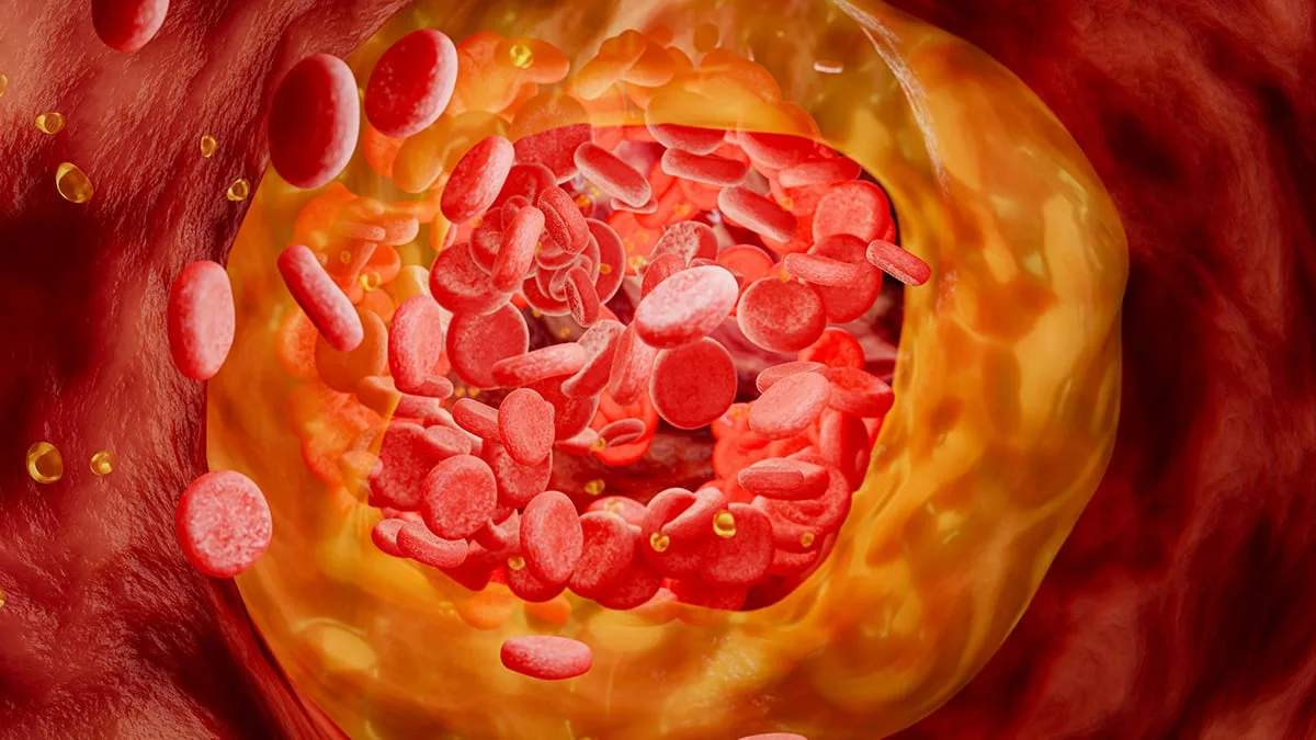 BloodVessels