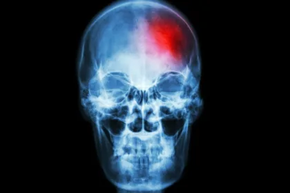 skull x ray red paln flare