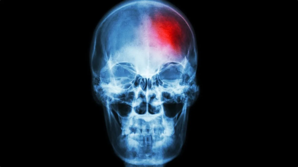 skull x ray red paln flare